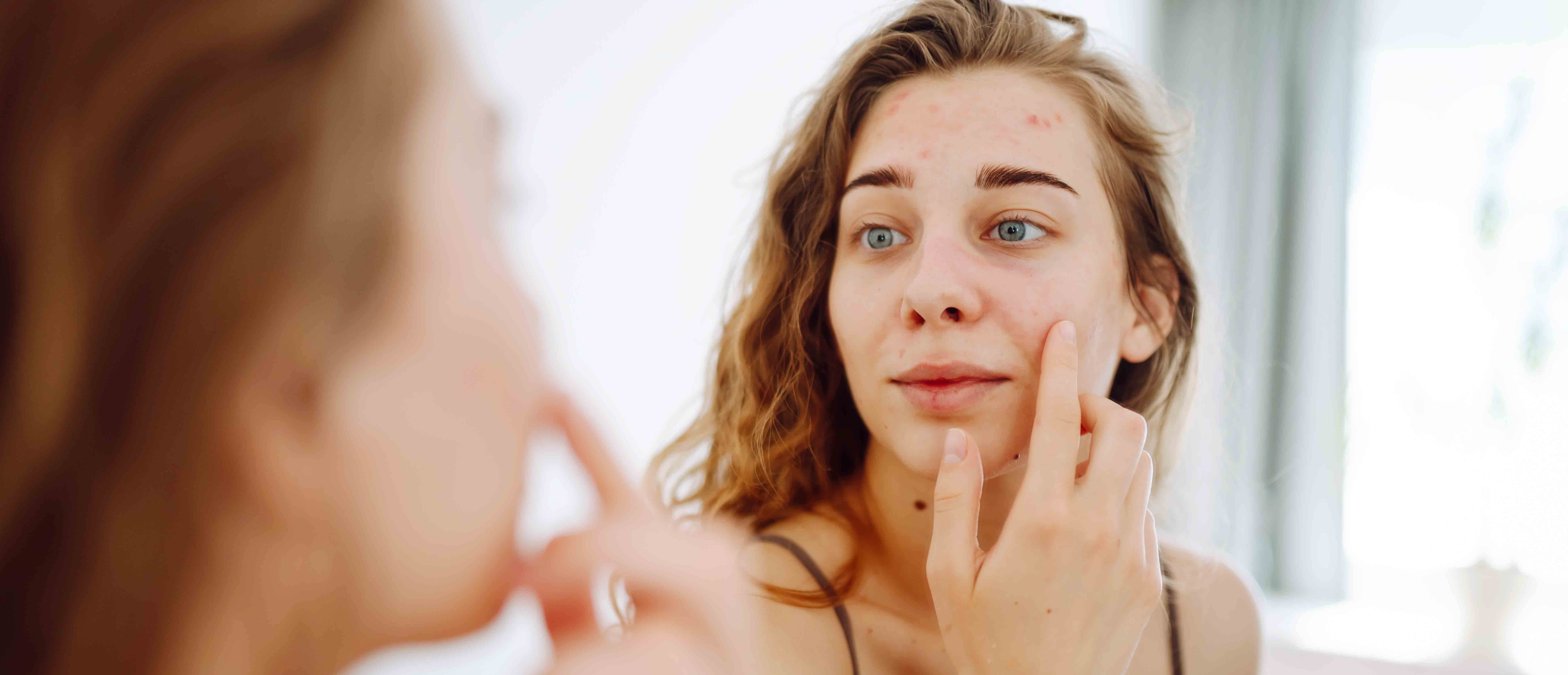 Eliminar puntos con láser CO2 - Hospital Virgen del Mar